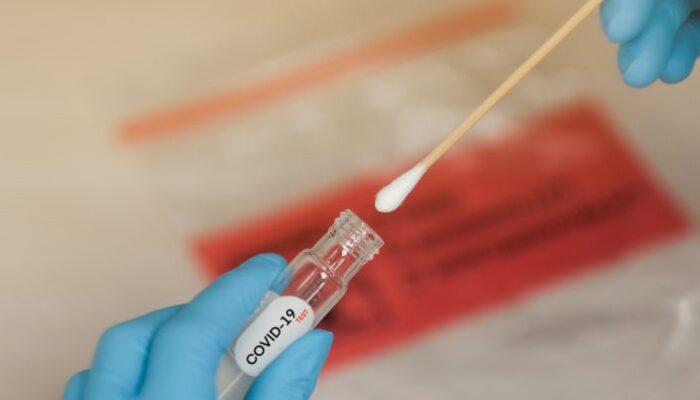 Testagem em massa aumenta prevenção contra Covid-19 em Limoeiro